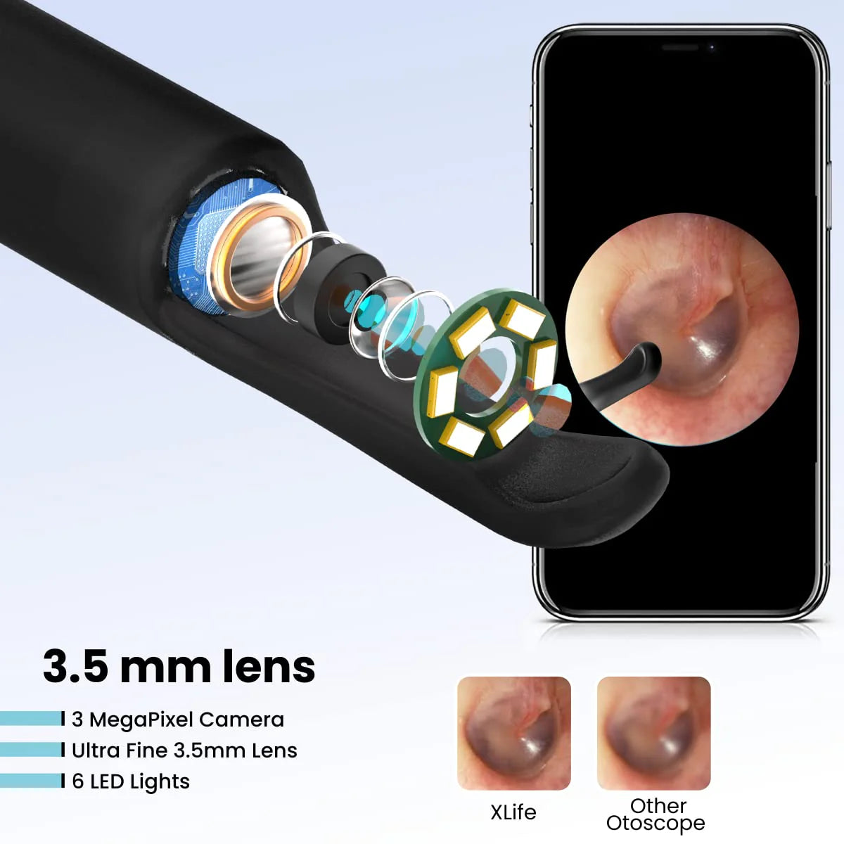 PORTRONICS Xlife Smart Wireless Ear Cleaning | Ultralight&Fine | 1080p Camera | 3.5mm Lens | 30 Min. Playtime
